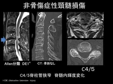 北垣骨傷